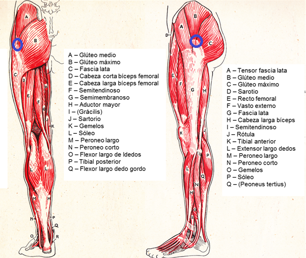 Dolor del biceps femoral