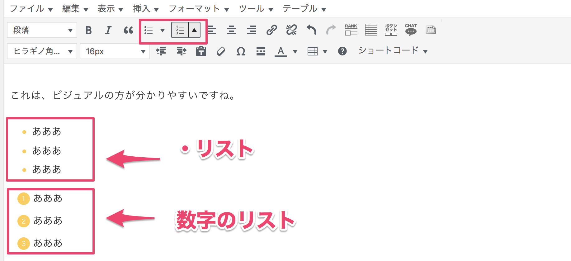 リスト