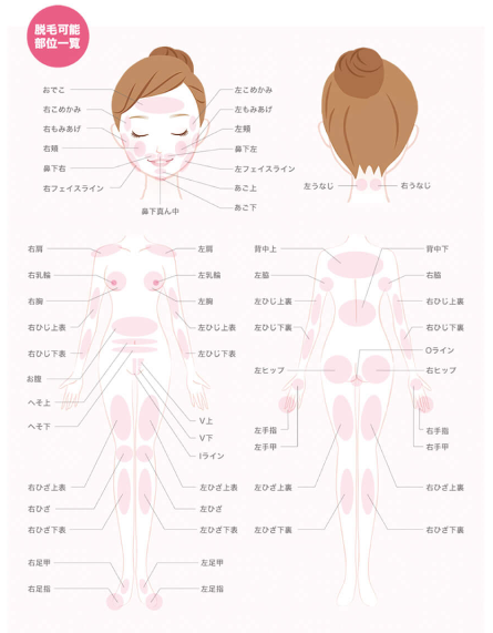 ストラッシュの脱毛範囲画像 ストラッシュの脱毛範囲画像