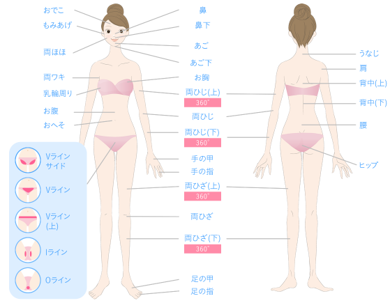 キレイモの脱毛範囲画像 キレイモの脱毛範囲画像