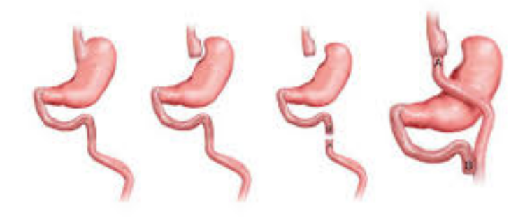 Best diet plan menopause photo 2