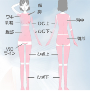 ミーナ町田ジェイクリニックの脱毛範囲画像 ミーナ町田ジェイクリニックの脱毛範囲画像