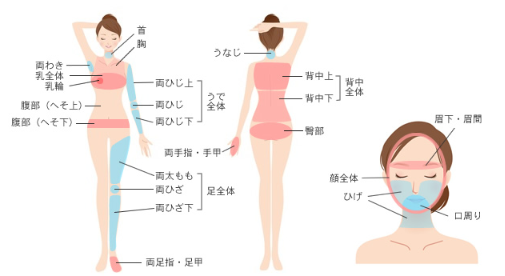 肌クリニック大宮の脱毛範囲画像 肌クリニック大宮の脱毛範囲画像