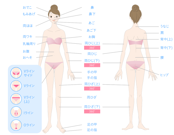 キレイモの脱毛範囲画像 キレイモの脱毛範囲画像