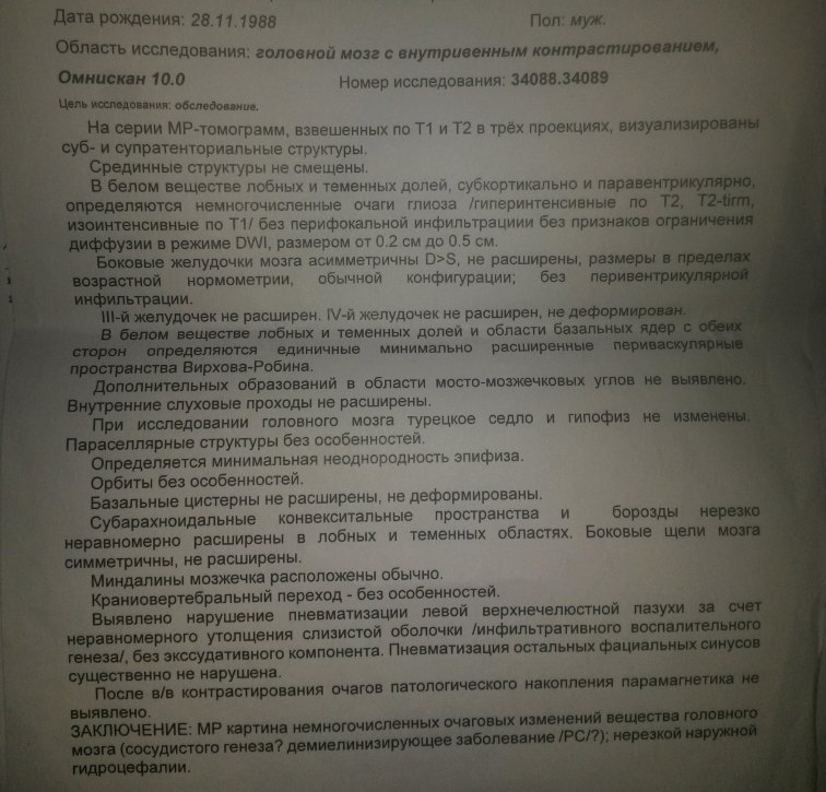 Сосудистые очаги в веществе головного мозга. Заключение мрт головного мозга при рассеянном склерозе. Мрт при рассеянном склерозе заключение. Рассеянный склероз на мрт головного мозга. Сосудистый генез.