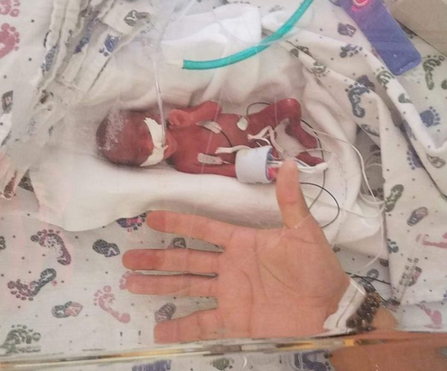 AMERICA IS Under Siege : Mother Gives Birth to Miracle 13-Ounce B...