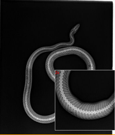 Personal Snake XRays