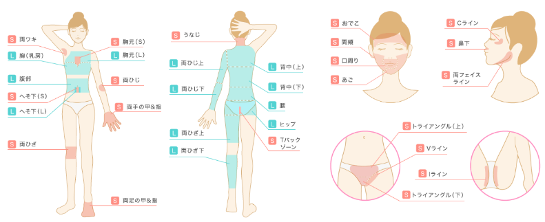 ジェイエステティックの脱毛範囲画像 ジェイエステティックの脱毛範囲画像