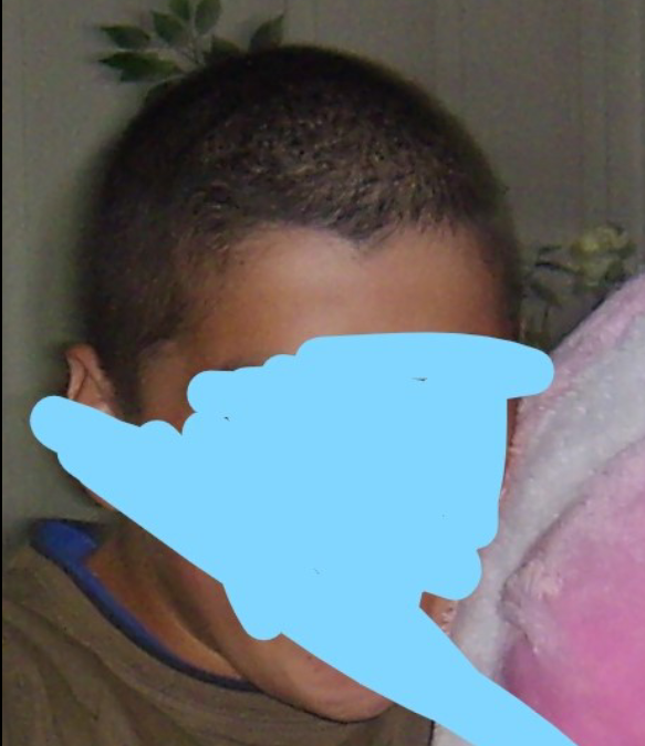 Need Advice Regarding Weird Shaped Heads And Bumps Bald