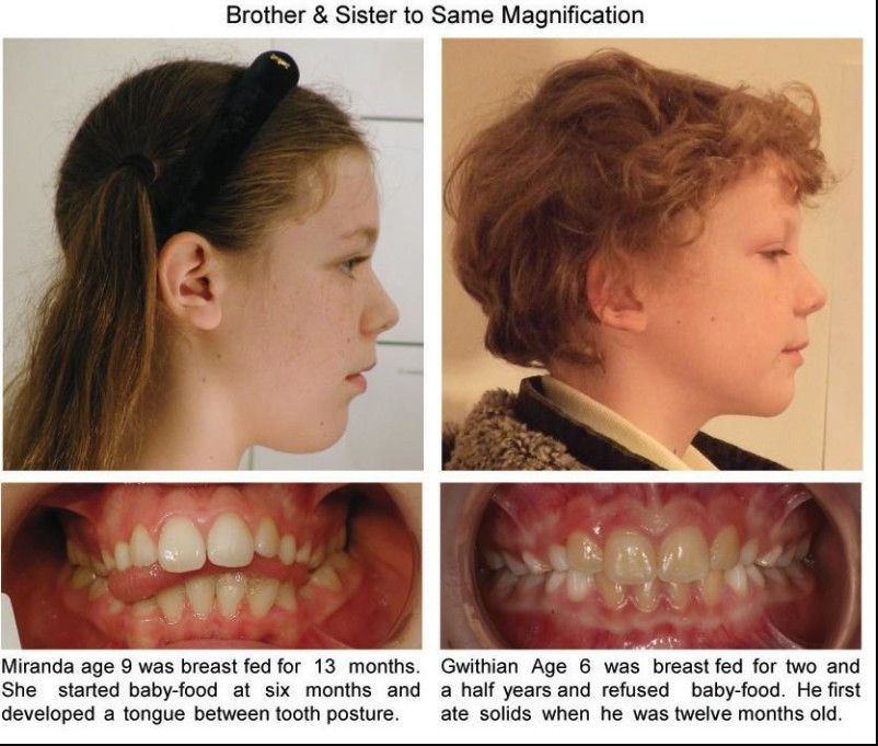 ELI5 why does your tongue rest at the roof of your mouth instead of